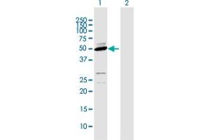 Western Blot analysis of CYP2D6 expression in transfected 293T cell line by CYP2D6 MaxPab polyclonal antibody. (CYP2D6 antibody  (AA 1-497))