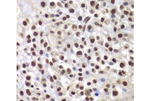 Immunohistochemistry of paraffin-embedded Mouse osteosarcoma using SMARCB1 Polyclonal Antibody at dilution of 1:200 (40x lens). (SMARCB1 antibody)