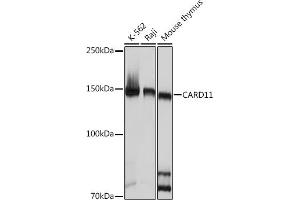 Western blot analysis of extracts of various cell lines, using C Rabbit mAb (ABIN7266125) at 1:1000 dilution. (CARD11 antibody)