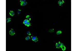 Immunofluorescence staining of MCF-7 cells with ABIN7144635 at 1:133, counter-stained with DAPI. (ARRDC1 antibody  (AA 288-433))