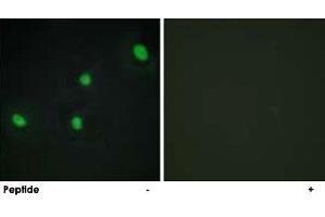 Immunofluorescence analysis of HepG2 cells, using CDCA4 polyclonal antibody .