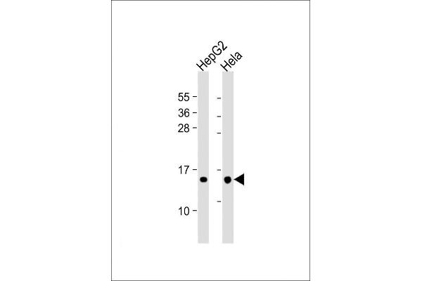 THEM2 antibody