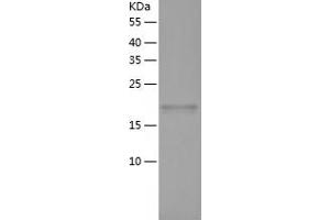 RWDD4A Protein (AA 1-188) (His tag)