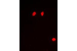 Immunofluorescent analysis of Histone H3 (pS10) staining in Raw264. (Histone 3 antibody  (pSer10))
