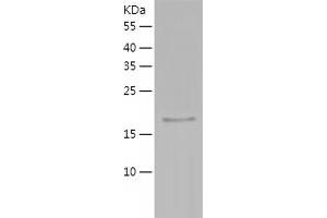 Western Blotting (WB) image for Peroxiredoxin 3 (PRDX3) (AA 63-256) protein (His tag) (ABIN7285909) (Peroxiredoxin 3 Protein (PRDX3) (AA 63-256) (His tag))