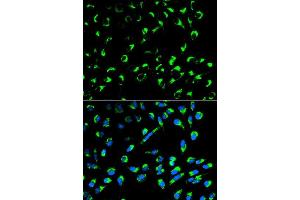 Immunofluorescence analysis of MCF7 cell using SFN antibody. (14-3-3 sigma/SFN antibody  (AA 1-248))