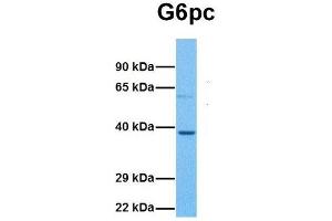 Host:  Rabbit  Target Name:  G6pc  Sample Tissue:  Mouse Lung  Antibody Dilution:  1. (G6PC antibody  (N-Term))