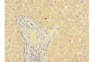 IHC analysis of paraffin-embedded human liver tissue, using MR1 antibody (1/100 dilution). (MR1 antibody  (AA 150-253))