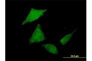 Immunofluorescence of purified MaxPab antibody to C9orf96 on HeLa cell. (C9orf96 antibody  (AA 1-680))