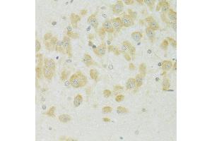 Immunohistochemistry of paraffin-embedded rat brain using SLC37 antibody (ABIN7270453) at dilution of 1:100 (40x lens). (SLC37A4 antibody  (C-Term))