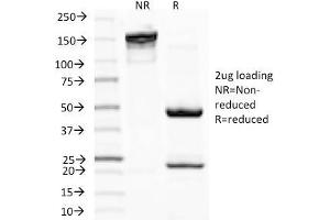 SDS-PAGE Analysis Purified MITF Mouse Monoclonal Antibody (D5). (MITF antibody)