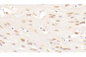 Detection of WNT5A in Mouse Cerebrum Tissue using Monoclonal Antibody to Wingless Type MMTV Integration Site Family, Member 5A (WNT5A) (WNT5A antibody  (AA 62-380))