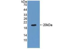 Figure. (MRPL1 antibody  (AA 147-285))