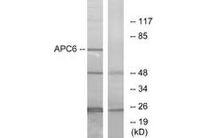 Western blot analysis of extracts from NIH-3T3 cells, using APC6 Antibody.