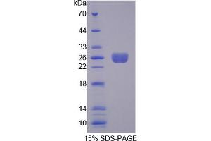 Image no. 1 for Transgelin (TAGLN) (AA 1-201) protein (His tag) (ABIN6236914)