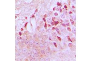Immunohistochemical analysis of TSC2 (pT1462) staining in human brain formalin fixed paraffin embedded tissue section.