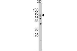 Western blot analysis of DYRK1A polyclonal antibody  in 293 cell line lysates (35 ug/lane). (DYRK1A antibody  (N-Term))