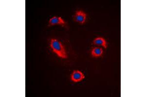 Immunofluorescent analysis of MMP10 staining in Jurkat cells. (MMP10 antibody  (C-Term))