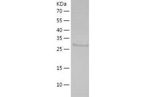 Western Blotting (WB) image for Sulfotransferase Family 1E Member 1 (SULT1E1) (AA 1-294) protein (His tag) (ABIN7286315) (SULT1E1 Protein (AA 1-294) (His tag))