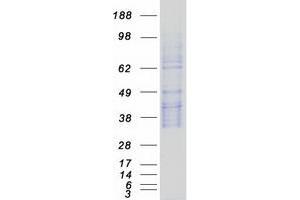 Western Blotting (WB) image for serine Peptidase Inhibitor, Kunitz Type, 2 (SPINT2) protein (Myc-DYKDDDDK Tag) (ABIN2732602)