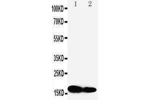 Anti-IFITM1 antibody, Western blotting Lane 1: SW620 Cell Lysate Lane 2: CEM Cell Lysate (IFITM1 antibody  (N-Term))