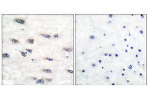 Immunohistochemistry (IHC) image for anti-Neurotrophic Tyrosine Kinase, Receptor, Type 1 (NTRK1) (pTyr791) antibody (ABIN1847224) (TRKA antibody  (pTyr791))