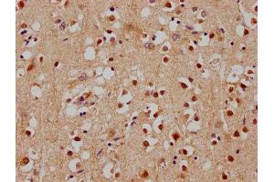 IHC image of ABIN7140181 diluted at 1:100 and staining in paraffin-embedded human brain tissue performed on a Leica BondTM system. (SOX1 antibody  (AA 49-68))