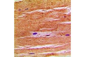 Immunohistochemical analysis of NHE8 staining in human skeletal muscle formalin fixed paraffin embedded tissue section. (NHE8 antibody  (C-Term))