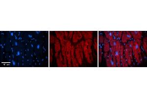 Rabbit Anti-KIF23 Antibody    Formalin Fixed Paraffin Embedded Tissue: Human Adult heart  Observed Staining: Cytoplasmic (cytoskeleton) Primary Antibody Concentration: 1:600 Secondary Antibody: Donkey anti-Rabbit-Cy2/3 Secondary Antibody Concentration: 1:200 Magnification: 20X Exposure Time: 0. (KIF23 antibody  (Middle Region))