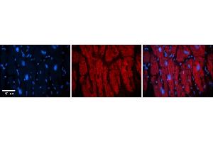 Rabbit Anti-KIF23 Antibody    Formalin Fixed Paraffin Embedded Tissue: Human Adult heart  Observed Staining: Cytoplasmic (cytoskeleton) Primary Antibody Concentration: 1:600 Secondary Antibody: Donkey anti-Rabbit-Cy2/3 Secondary Antibody Concentration: 1:200 Magnification: 20X Exposure Time: 0. (KIF23 antibody  (Middle Region))