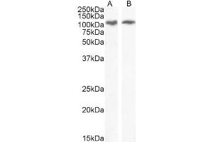 ABIN308413 (0. (ERN1 antibody  (Internal Region))