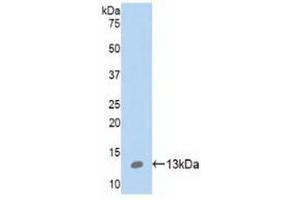 Detection of Recombinant S100A10, Human using Polyclonal Antibody to S100 Calcium Binding Protein A10 (S100A10) (S100A10 antibody  (AA 1-96))