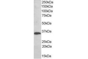 Image no. 1 for anti-Thioredoxin-Related Transmembrane Protein 1 (TMX1) (C-Term) antibody (ABIN374090) (TMX1 antibody  (C-Term))