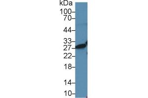 Western blot analysis of Human Jurkat cell lysate, using Rat HMG1 Antibody (2 µg/ml) and HRP-conjugated Goat Anti-Rabbit antibody (