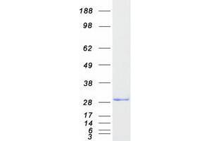 Validation with Western Blot (CENPH Protein (Myc-DYKDDDDK Tag))