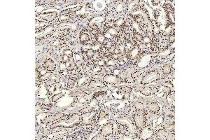 IHC analysis of U1A/SNRPA using anti-U1A/SNRPA antibody (ABIN7600891). (SNRPA1 antibody  (AA 25-218))