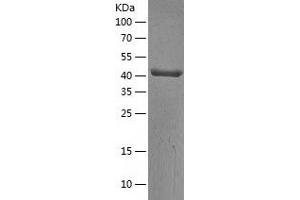 AHCY Protein (AA 1-432) (His tag)