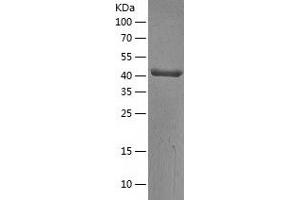 Western Blotting (WB) image for Adenosylhomocysteinase (AHCY) (AA 1-432) protein (His tag) (ABIN7121711) (AHCY Protein (AA 1-432) (His tag))