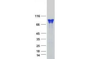 Validation with Western Blot (CTNNA1 Protein (Myc-DYKDDDDK Tag))