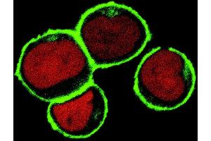 Confocal microscopy Subcellular localization of NTAL by confocal microscopy in THP-1 human acute monocytic leukemia cell line. (LAT2 antibody  (Cytoplasmic Domain))