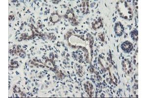 Immunohistochemical staining of paraffin-embedded Human breast tissue using anti-DPH2 mouse monoclonal antibody. (DPH2 antibody)