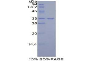 SDS-PAGE analysis of Mouse IGF2BP2 Protein. (IGF2BP2 Protein)