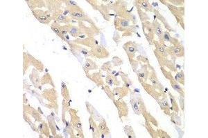 Immunohistochemistry of paraffin-embedded Mouse heart using CCT3 Polyclonal Antibody at dilution of 1:100 (40x lens). (CCT3 antibody)