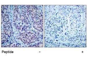 Image no. 1 for anti-Histone Deacetylase 2 (HDAC2) (AA 392-396) antibody (ABIN197336) (HDAC2 antibody  (AA 392-396))