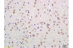 Formalin-fixed and paraffin embedded rat brain labeled with Anti-UBL7 Polyclonal Antibody, Unconjugated  at 1:100 followed by conjugation to the secondary antibody and DAB staining