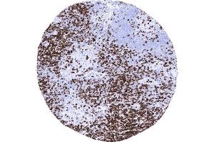Tonsil Strong CD7 positivity of T lymphocytes mainly in the interfollicular area (Recombinant CD7 antibody)