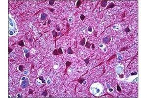 Human Brain, Cortex: Formalin-Fixed, Paraffin-Embedded (FFPE) (DPYSL2 antibody  (C-Term))