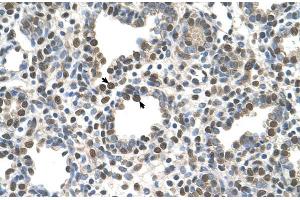 Human Lung (ZDHHC13 antibody  (N-Term))