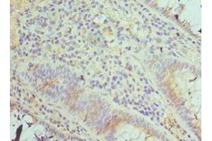 Immunohistochemistry (IHC) image for anti-TGF-beta Activated Kinase 1/MAP3K7 Binding Protein 1 (TAB1) (AA 205-504) antibody (ABIN7171965)