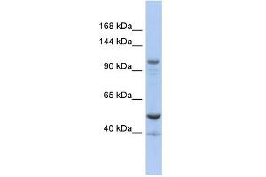 WB Suggested Anti-DDX58 Antibody Titration:  0. (DDX58 antibody  (Middle Region))